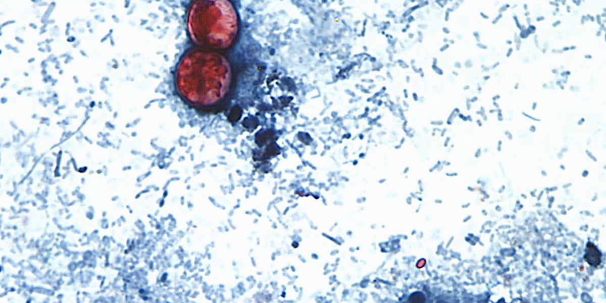 US health officials are investigating a new outbreak of a diarrhea-causing parasite